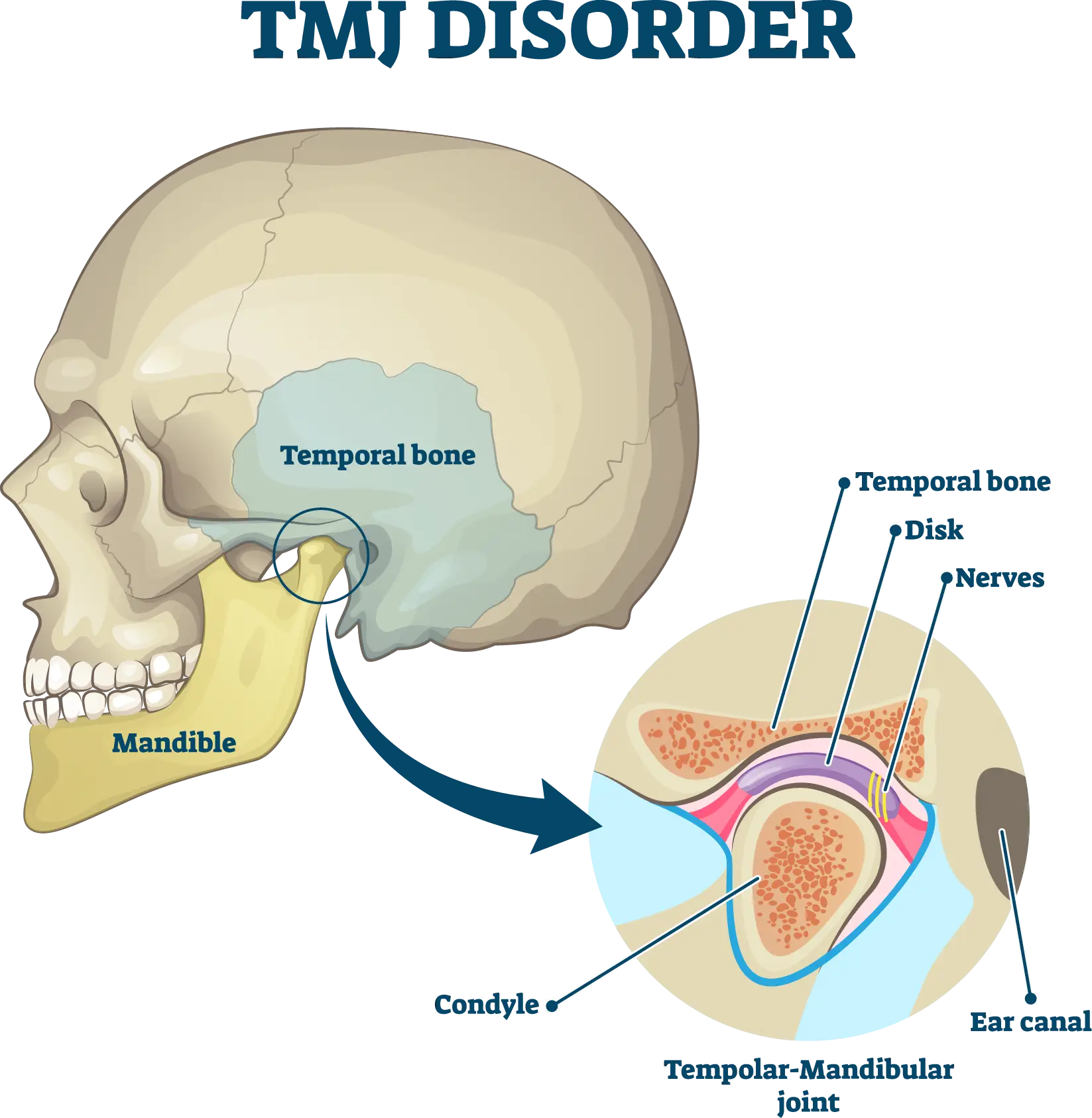 TMJ Infographic
