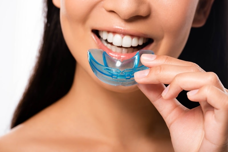 Custom oral appliance for snoring