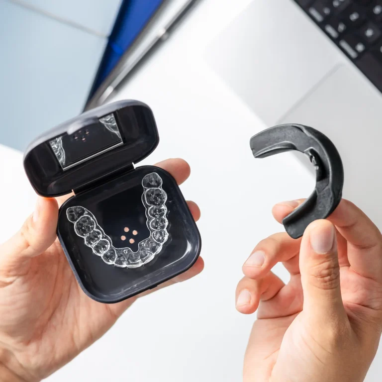 Nuvola Clear Aligners