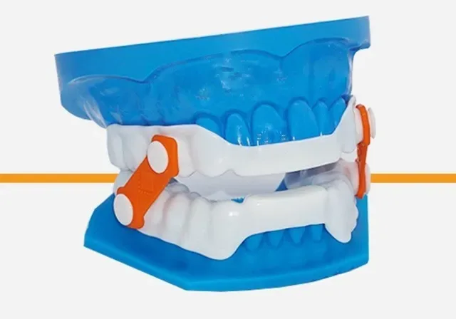 DDSO Custom oral appliance for sleep apnea